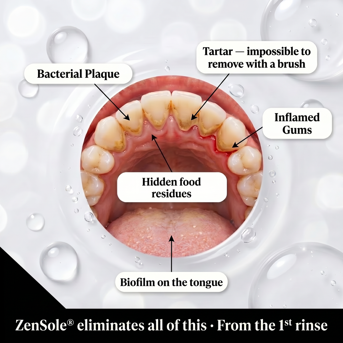 ZenSole® Whitening Mouthwash